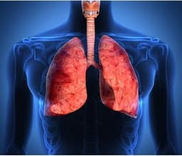 asthma