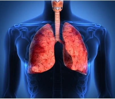 asthma