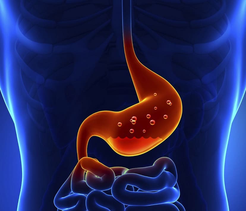 acid-reflux